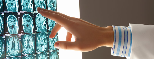 philadelphia brain injury lawyer