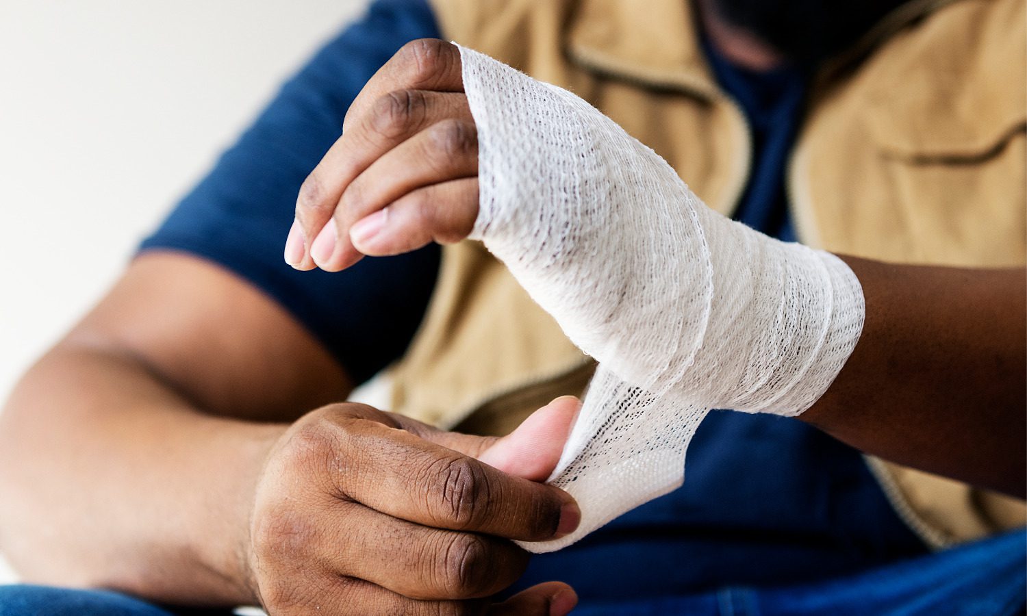 Burn Injury Lawyer