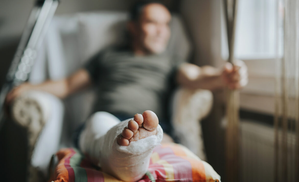 Man with broken leg at home