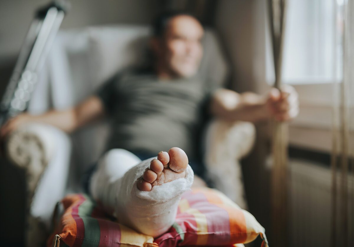 Man with broken leg at home